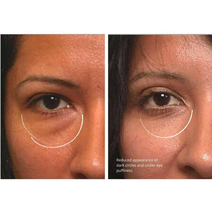 Before and after transformation of a woman using eye serum